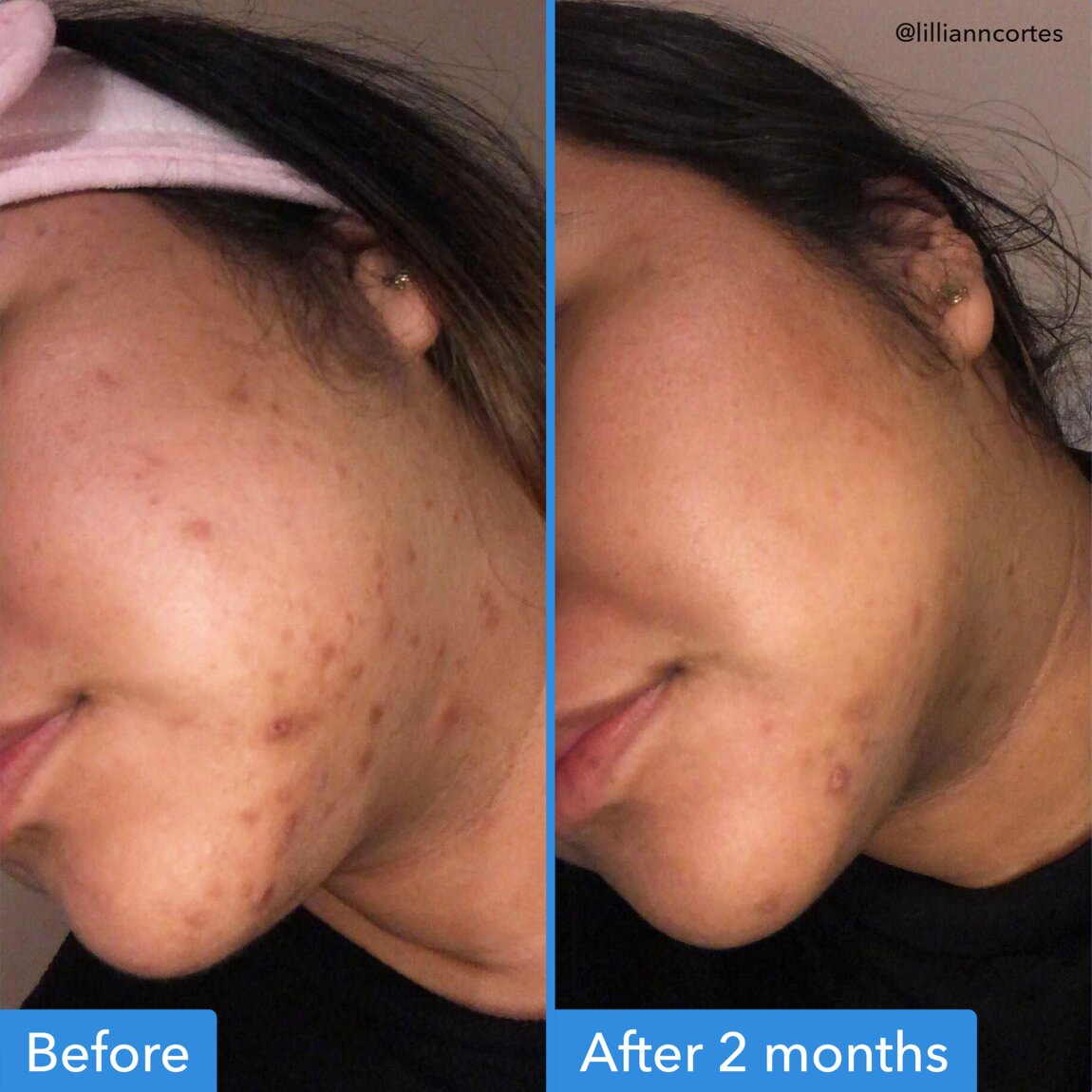 discoloration-correcting-serum-d9 zb_p.jpg