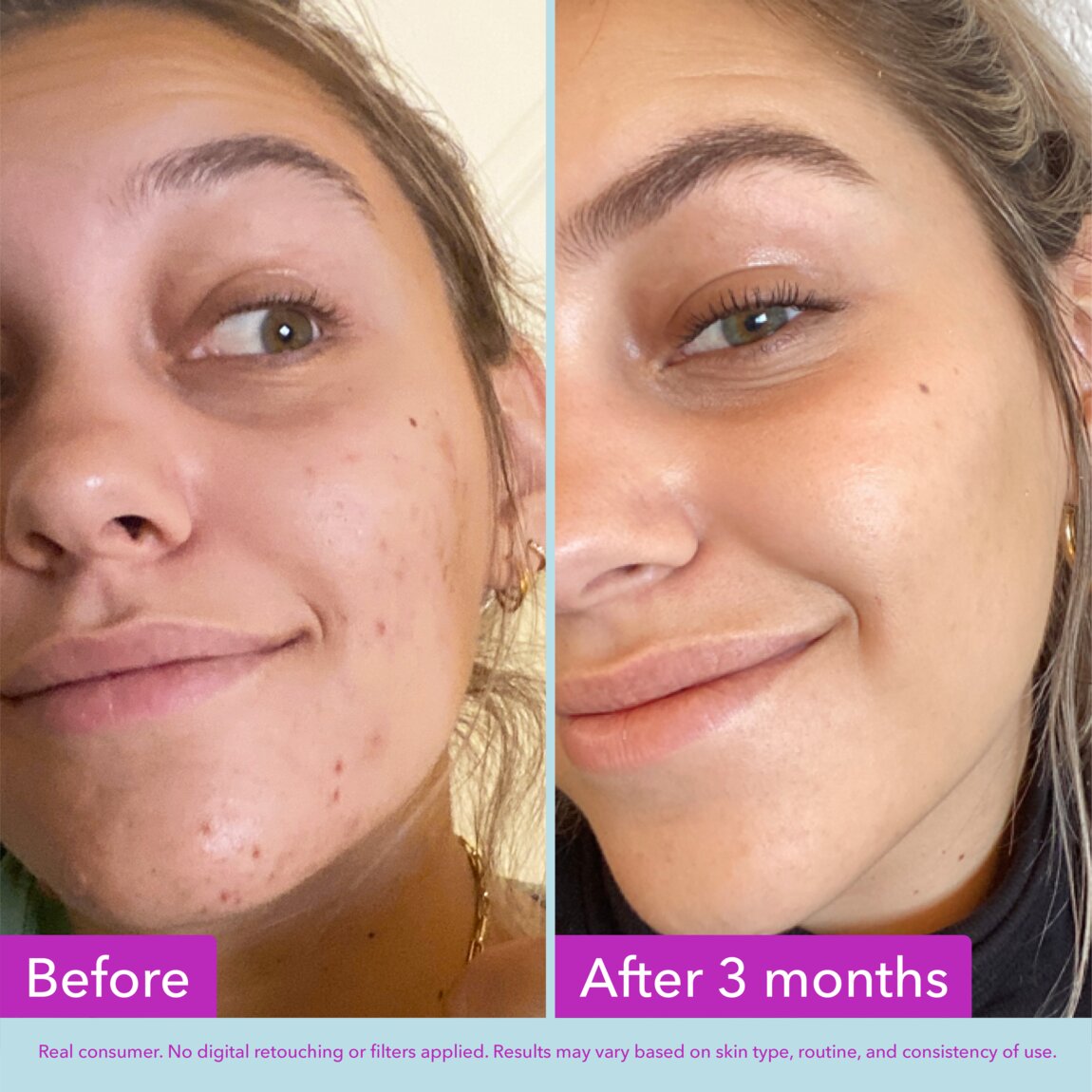 niacinamide-brightening-toner-d6 zb_p.jpg