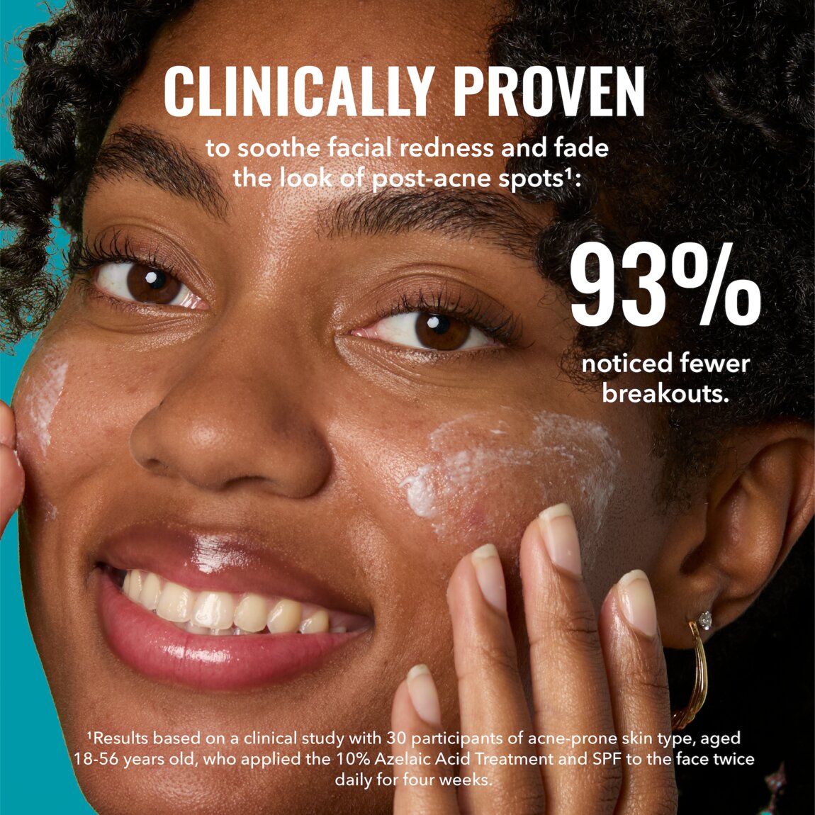 10-azelaic-acid-treatment-h2 zb_p.jpg